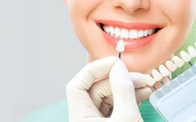 Teeth whitening in Hiranandani Estate