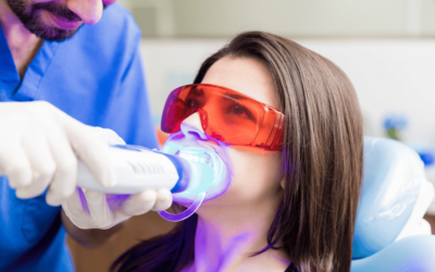 HOW LONG DOES LASER TEETH WHITENING TREATMENT LAST.