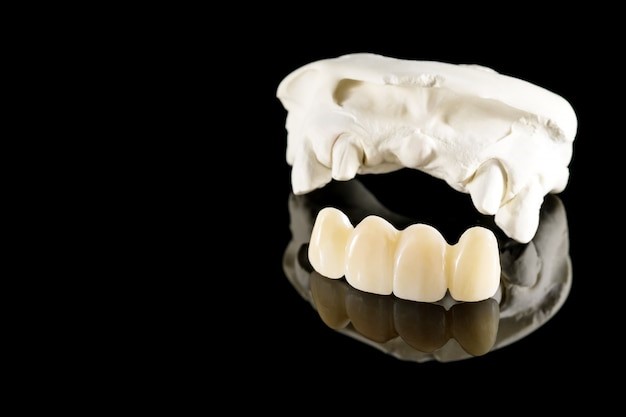 Understanding Zirconia Dental Crowns: The Perfect Blend of Strength and Aesthetics